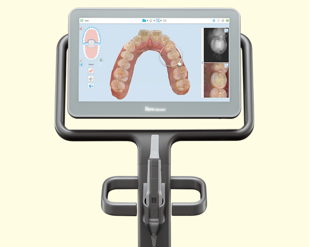 Escaneamento digital do sorriso: o futuro da odontologia já chegou